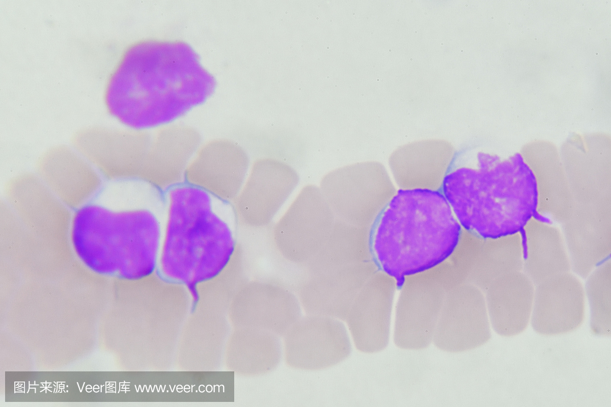 嗜曙红细胞,嗜酸性粒细胞,嗜碱细胞,嗜碱成分