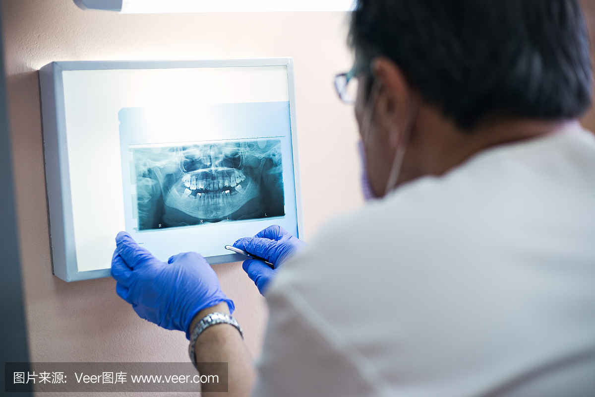 牙科橡皮障,牙科用橡皮布,齿科橡皮障,拔牙钳