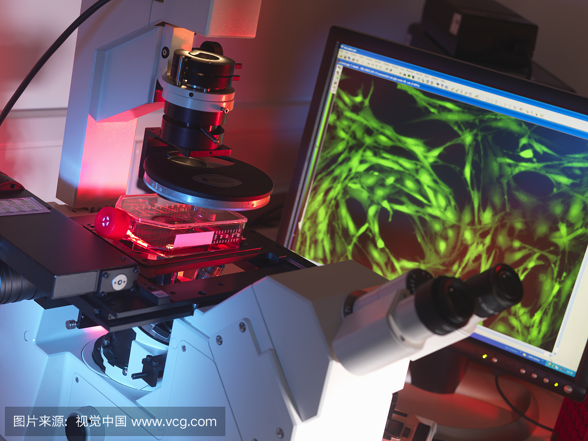 倒置显微镜观察烧瓶中的干细胞,显示荧光标记