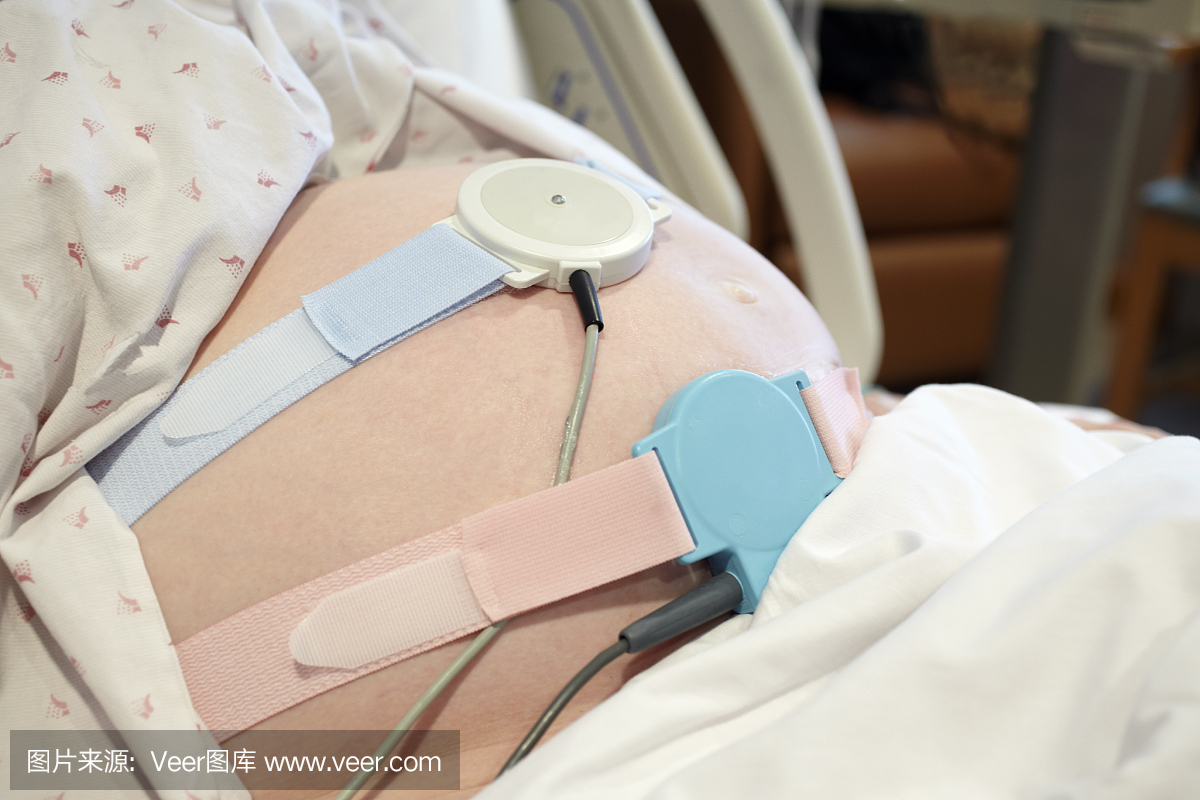 怀孕胎儿监测妇女腹部的传感器