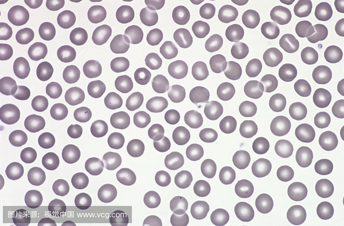正常人红细胞或红细胞在外周血涂片。 Wright