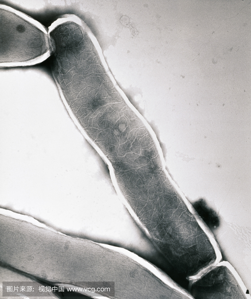 阴性染色的麻风病细菌分枝杆菌从lepromatous