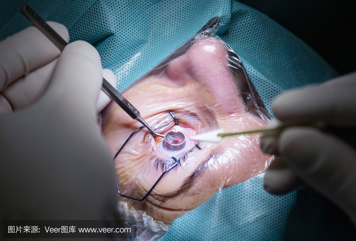 眼部手术,割双眼皮,近视眼手术,眼科一声