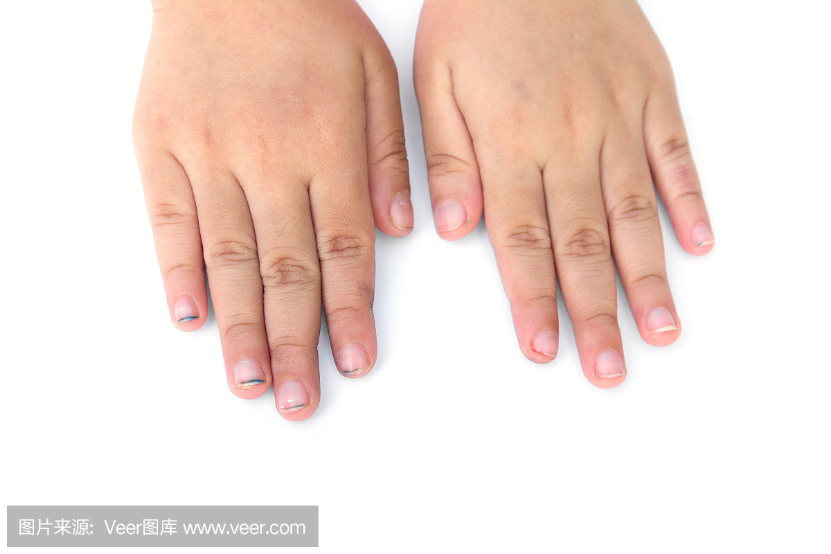 孩子长指甲孤立在白色背景上。儿童脏指甲隔离