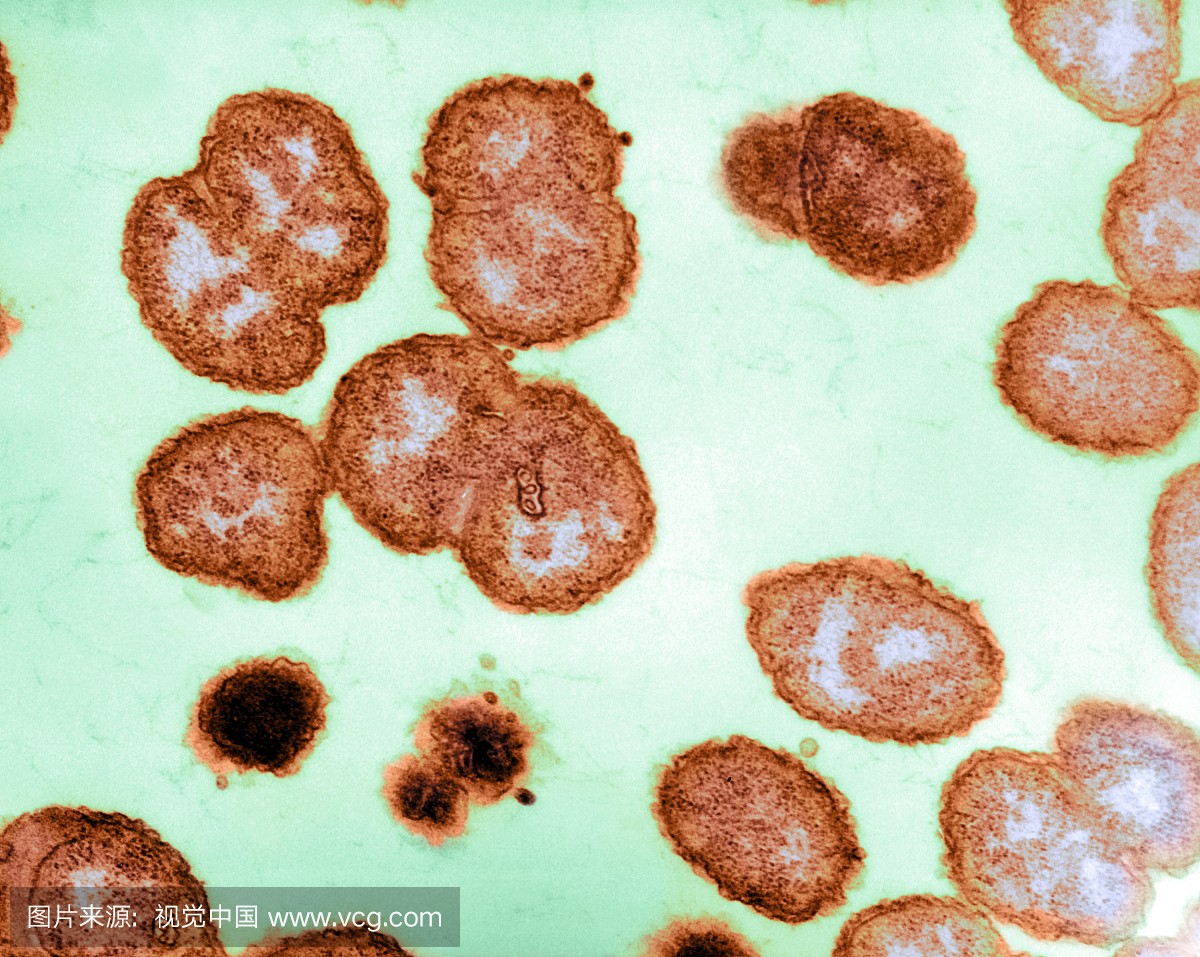 淋病奈瑟氏球菌的电子显微照片,一种负责性传