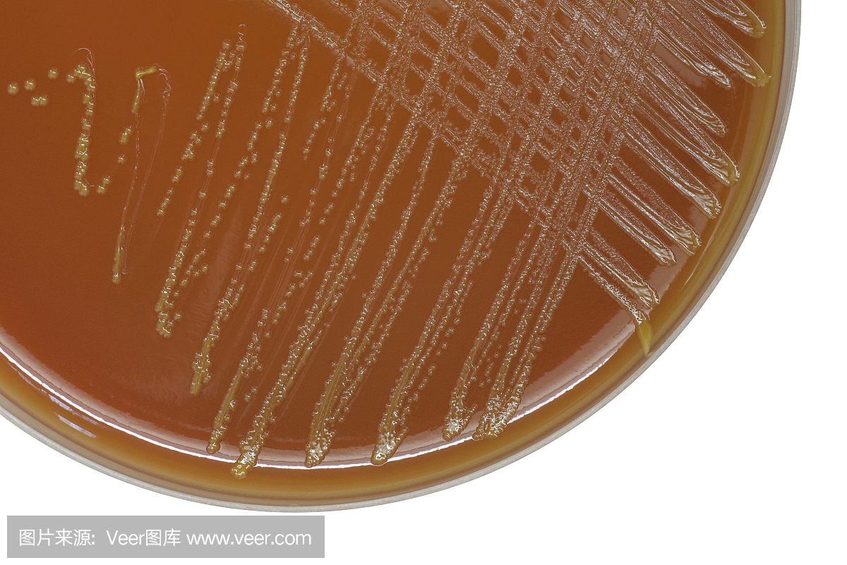 淋病奈瑟氏球菌细菌菌落在巧克力琼脂平板上