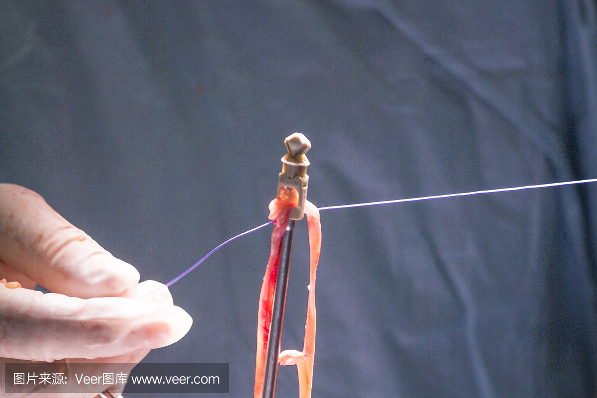 医院手术室急诊室创伤膝关节和骨科膝关节腱和