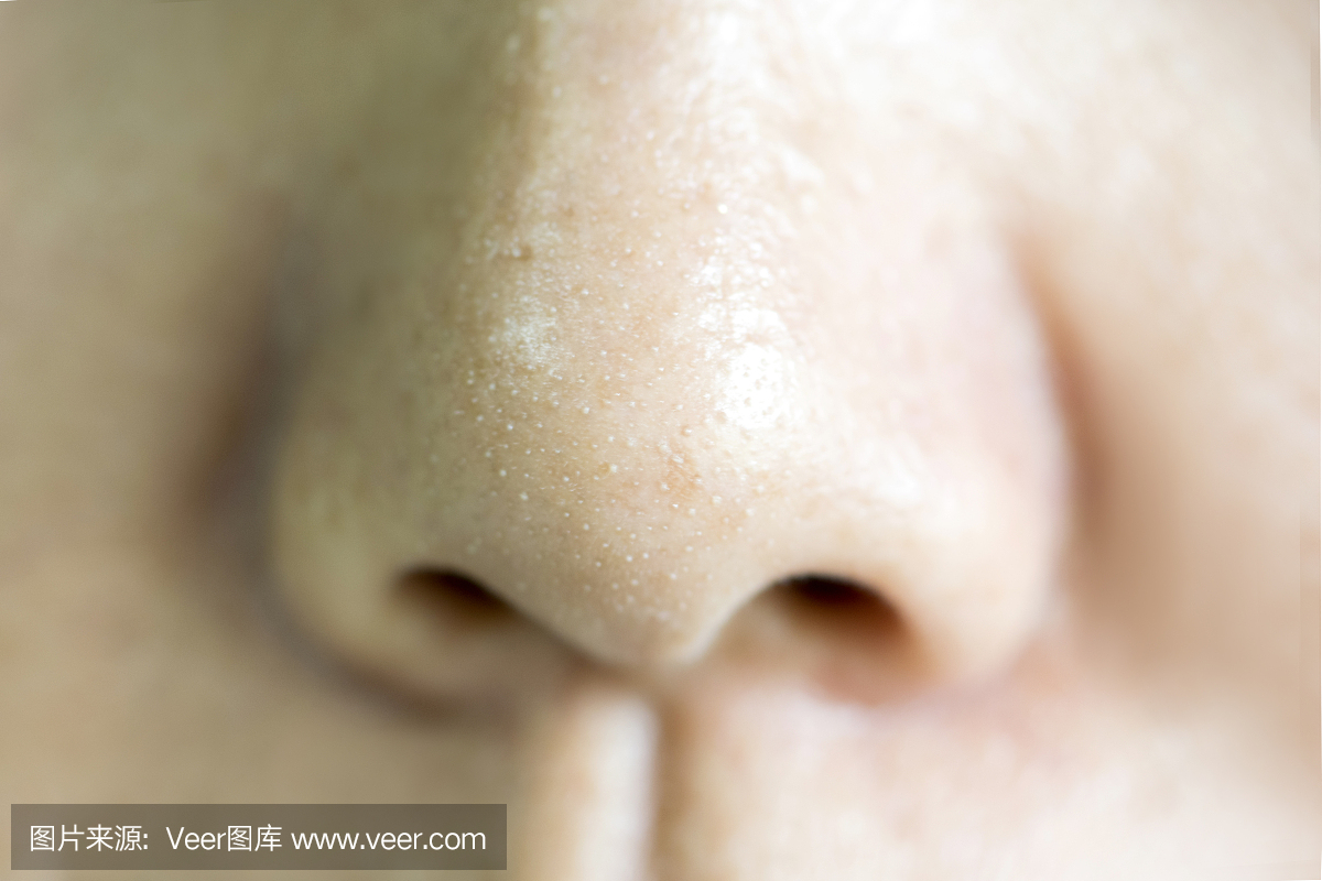 关闭在鼻子上的粉刺小丘疹。美容和健康的概念