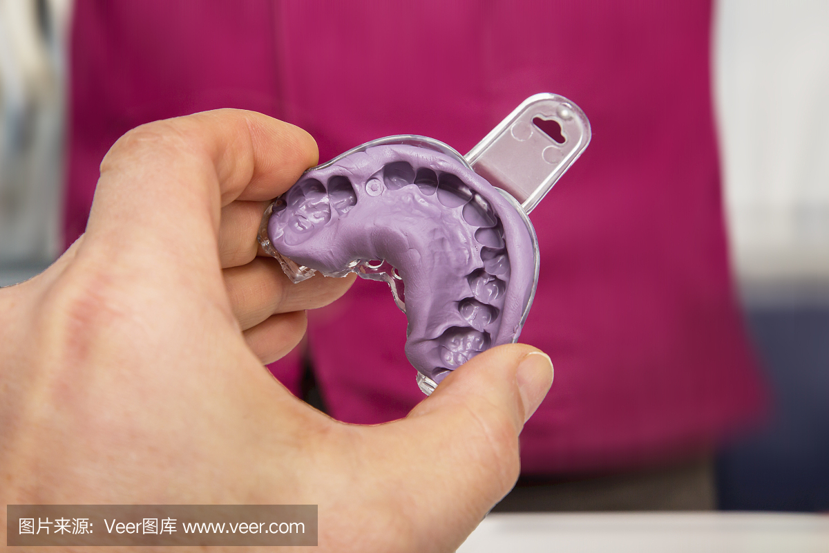 牙医手里拿着硅胶牙印