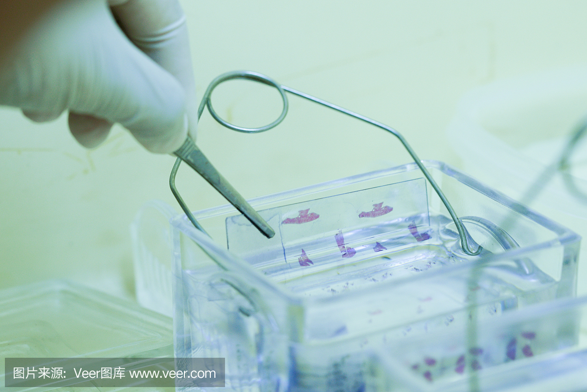显微镜载玻片染色组织活检在病理学实验室进行