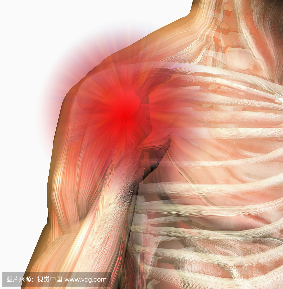 肩部疼痛。人类男性肩膀球窝关节,显示骨骼和