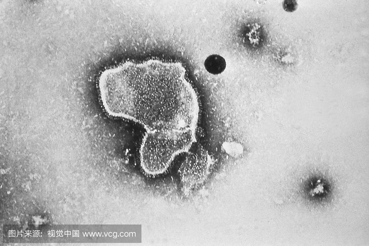 呼吸道合胞病毒(RSV)的电子显微照片。病毒粒