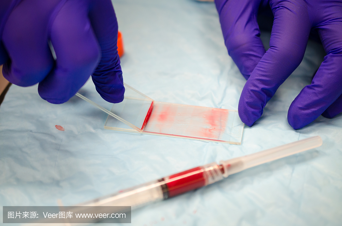 在显微镜载玻片上制备血涂片