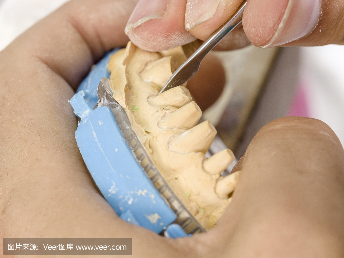 牙科技师用钻头建模植入物牙齿