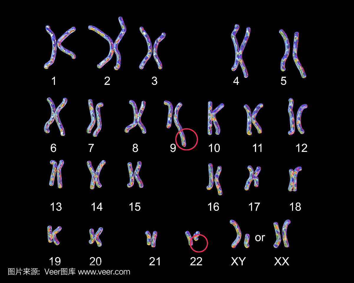 费城染色体核型