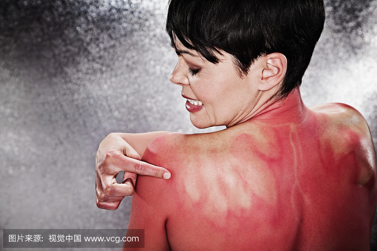 灼伤,一个人,青年女人,仅一个青年女人